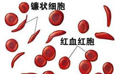 人體麻豆免费网站廠家介紹檢測微量元素的儀器 人體麻豆免费网站廠家介紹檢測微量元素的儀器